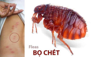 Bệnh nhân tăng do bọ chét đốt, cần nhận diện và điều trị kịp thời